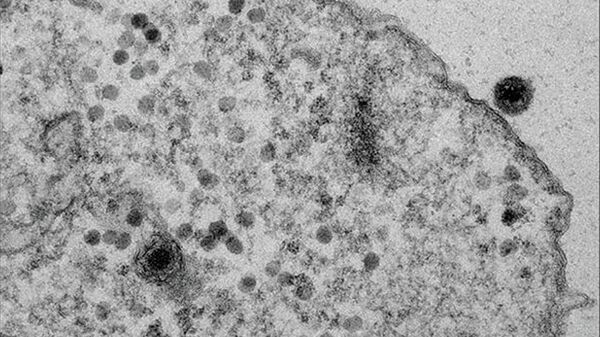 Яравирус Yaravirus brasiliensis в клетке амебы Яравирус Yaravirus brasiliensis в клетке амебы