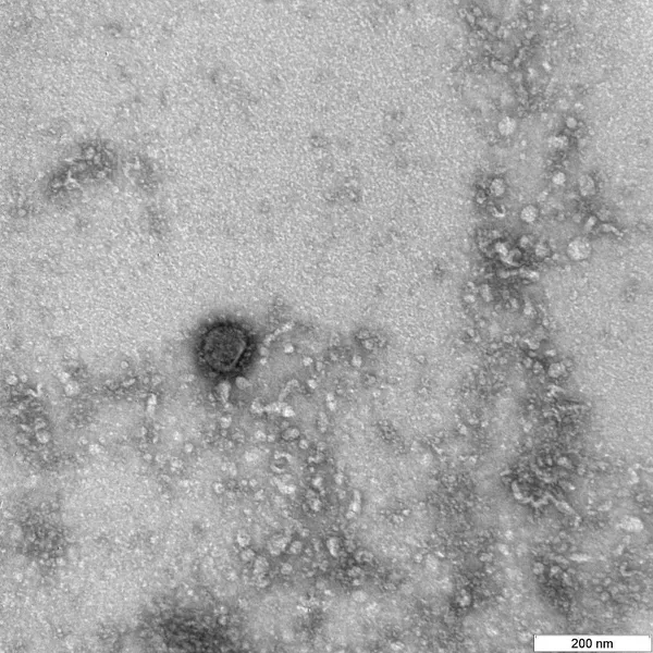 Снимок коронавируса COVID-19, опубликованный Роспотребнадзором