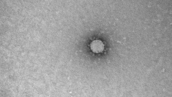 Выявлен новый способ передачи коронавируса