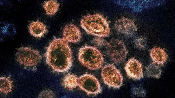 Коронавирус SARS-CoV-2 под электронным микроскопом