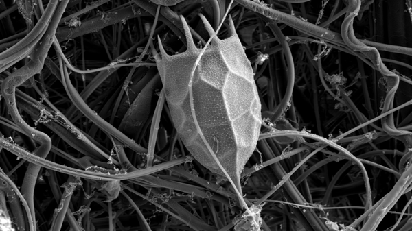 Локуль коловратки Keratella cochlearis, автор Анна Титова Локуль коловратки Keratella cochlearis, автор Анна Титова
