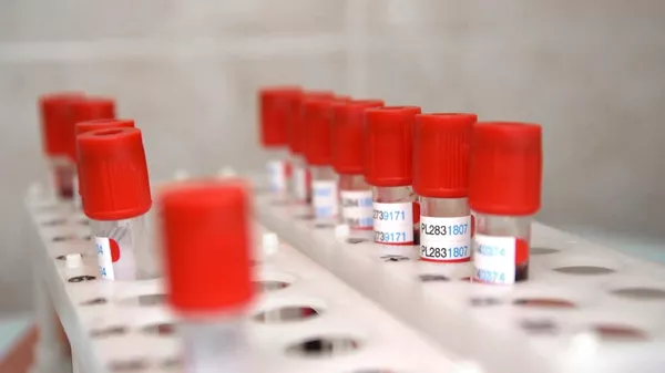 Пробирки с кровью для анализа перед выпиской добровольцев испытаний вакцины от коронавируса в Главном военном клиническом госпитале имени Н. Н. Бурденко