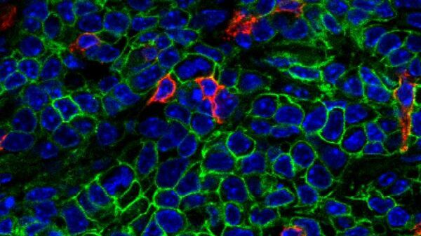 Ученые установили, как раковые клетки обходят иммунную защиту