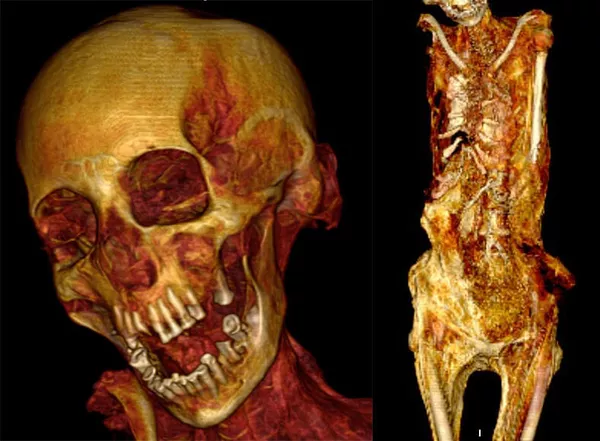 Радиологическое изображение мумии кричащей женщины, полученное в ходе исследования