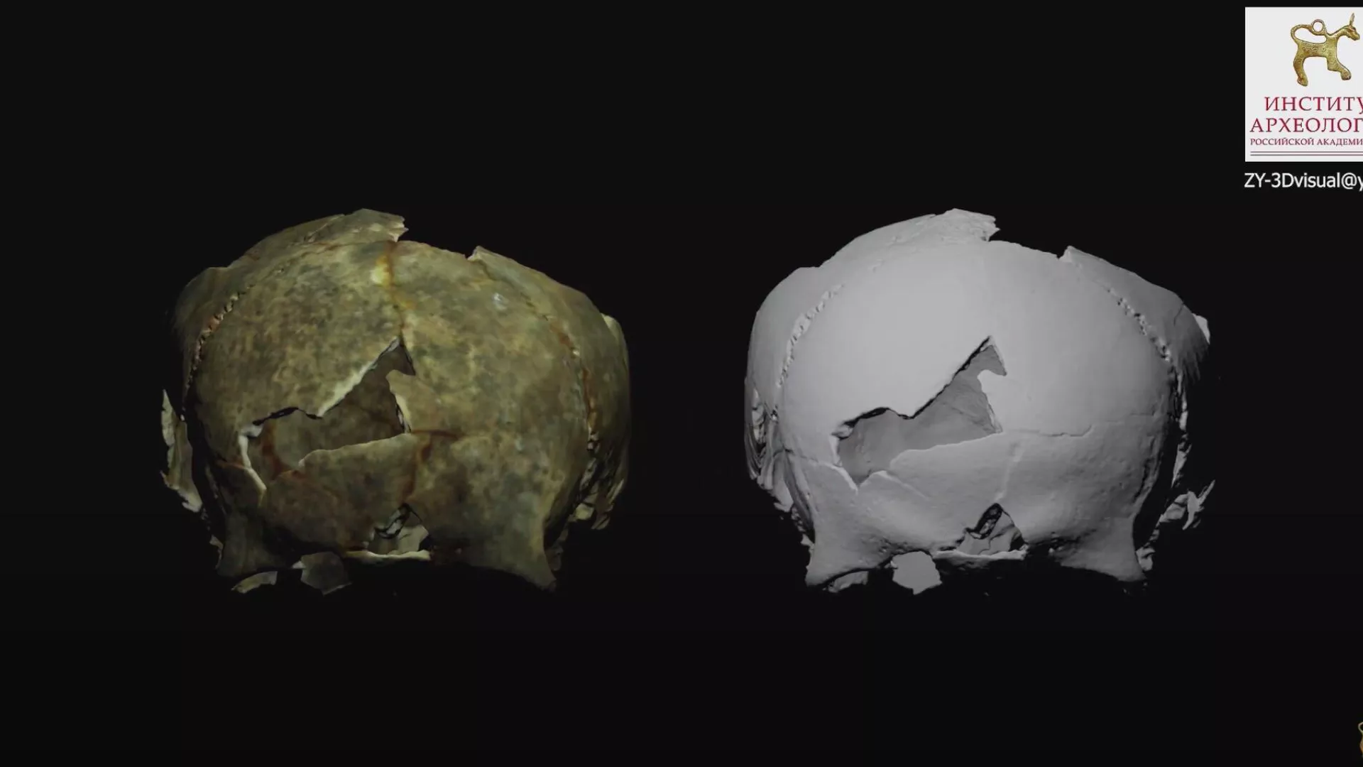 3D-моделирование трепанации черепа (село Льговское, Восточный Крым) - РИА Новости, 1920, 22.10.2020