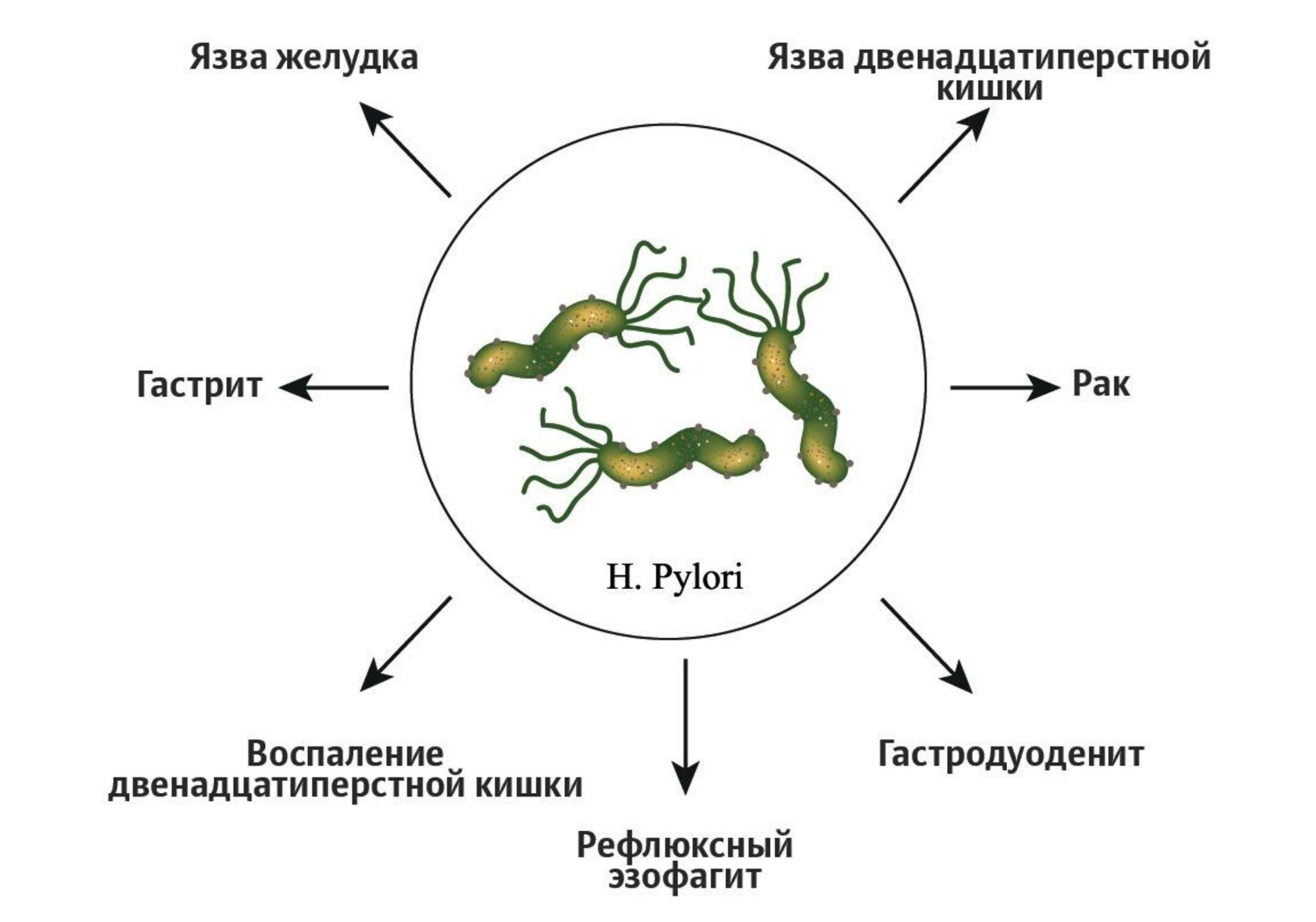 Болезни, вызванные Helicobacter pylori Болезни, вызванные Helicobacter pylori - РИА Новости, 1920, 27.10.2020