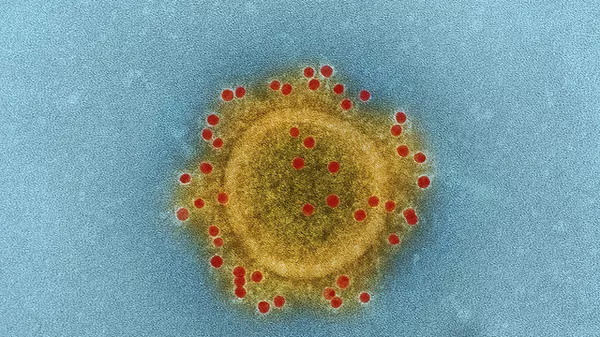 Микрофотография ближневосточного коронавируса