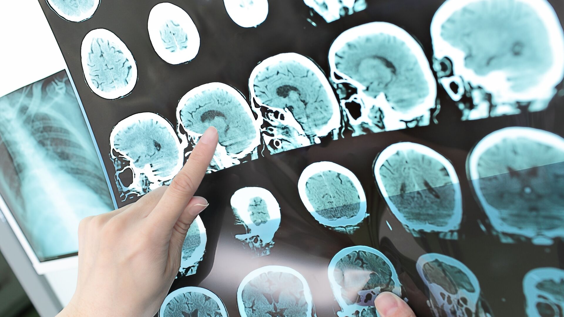 Ученые повысят качество и точность МРТ-сканирования мозга