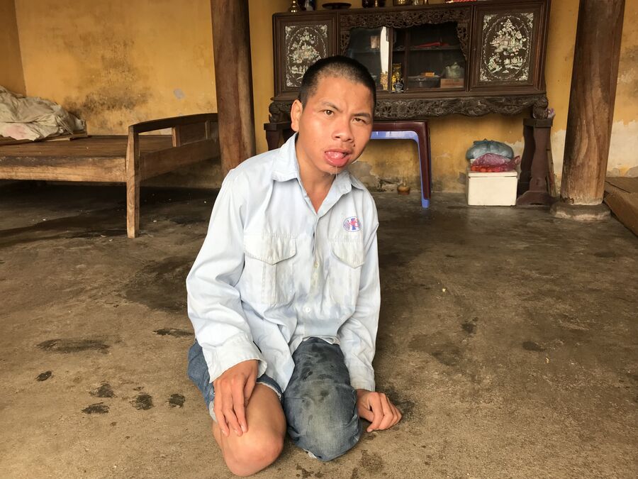 Фам Ван, сын Фам Тхи Ханг, жертва Агента Оранж