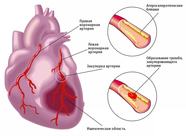 Учеными найден способ полностью восстановить сердце после инфаркта - фото 2