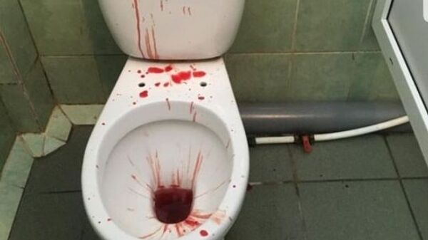 Унитаз в крови Унитаз в крови