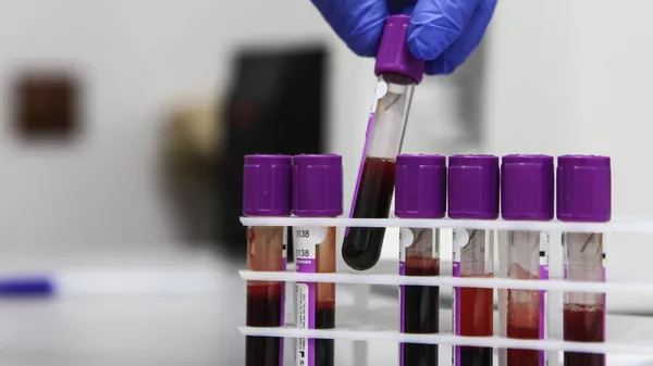 Пробирки с образцами крови для исследований в онкологическом диспансере