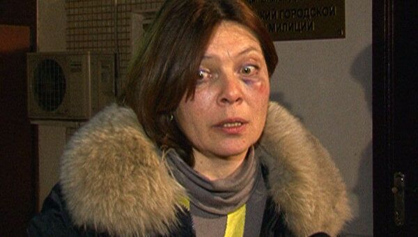 Наталья Сейбиль, заявившая об избиении сотрудником милиции Наталья Сейбиль, заявившая об избиении сотрудником милиции